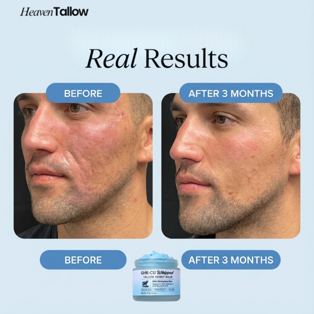 Balsamo di Sego e Miele al Blu di Metilene